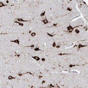 Anti-FAM83B antibody produced in rabbit 