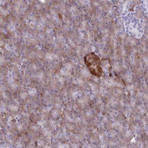 Anti-FAM86B1 antibody produced in rabbit 