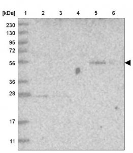 Anti-FAM98A antibody produced in rabbit HPA036251-100UL