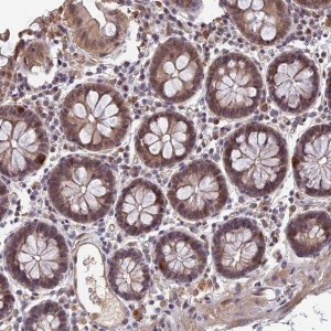 Anti-FAM98C antibody produced in rabbit 