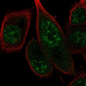Anti-FANCM antibody produced in rabbit 