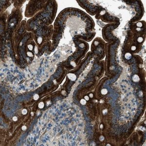 Anti-FAR1 antibody produced in rabbit 