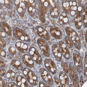 Anti-FASTK antibody produced in rabbit 