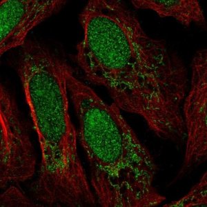 Anti-FASTKD3 antibody produced in rabbit 