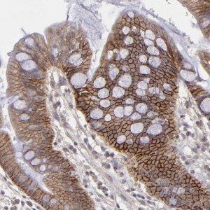 ANTI-FAT1 antibody produced in rabbit 