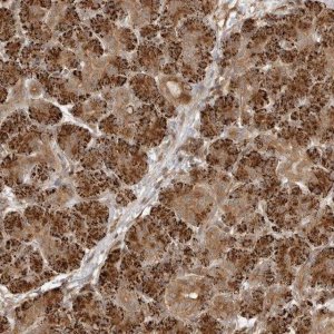 Anti-FAT3 antibody produced in rabbit 