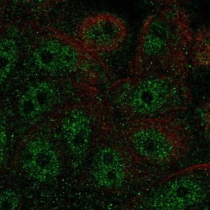 Anti-FBP2 antibody produced in rabbit 