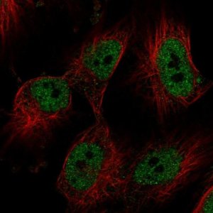 Anti-FBRS antibody produced in rabbit 