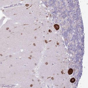 Anti-FBRSL1 antibody produced in rabbit 