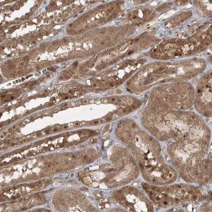 Anti-FBXL17 antibody produced in rabbit 