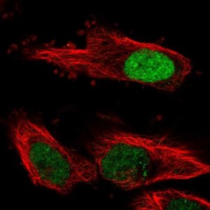 Anti-FBXL17 antibody produced in rabbit 