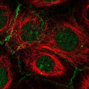 Anti-FBXL2 antibody produced in rabbit 