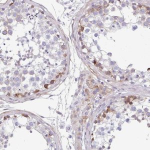 Anti-FBXL20 antibody produced in rabbit HPA050397-100UL