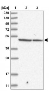 Anti-FBXL8 antibody produced in rabbit 