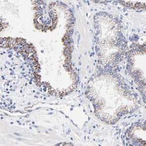 Anti-FBXO10 antibody produced in rabbit 