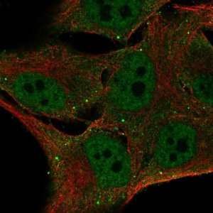Anti-FBXO16 antibody produced in rabbit 
