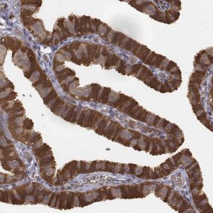 Anti-FBXO21 antibody produced in rabbit 