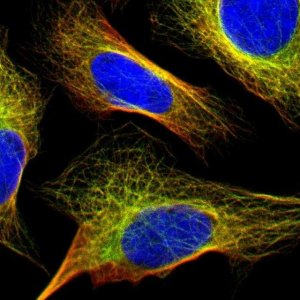 Anti-FBXO30 antibody produced in rabbit 