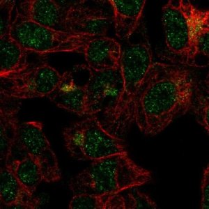 Anti-FBXO31 antibody produced in rabbit 