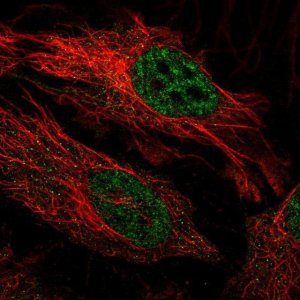 Anti-FBXO34 antibody produced in rabbit 