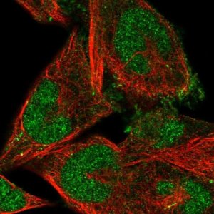 Anti-FBXO41 antibody produced in rabbit 