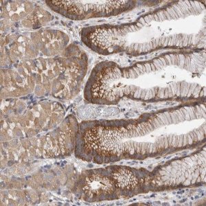 Anti-FBXO43 antibody produced in rabbit 