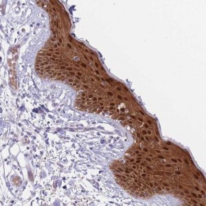 Anti-FBXO46 antibody produced in rabbit 