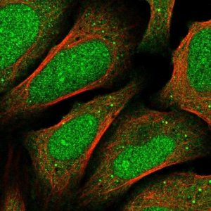 Anti-FBXO46 antibody produced in rabbit 