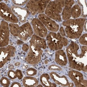 Anti-FBXO6 antibody produced in rabbit 