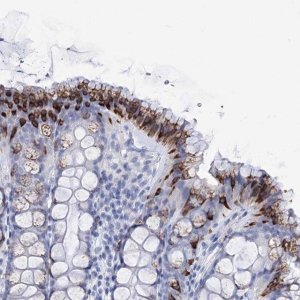 Anti-FBXW12 antibody produced in rabbit 