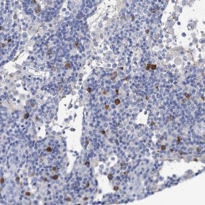 Anti-FBXW12 antibody produced in rabbit 