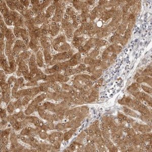 Anti-FDPS antibody produced in rabbit 
