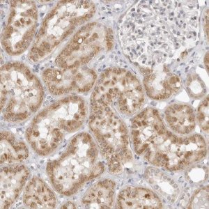 Anti-FDPS antibody produced in rabbit 