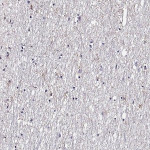 Anti-FEZF1 antibody produced in rabbit 