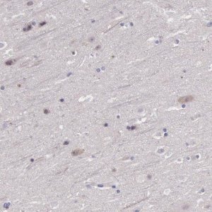 Anti-FGD1 antibody produced in rabbit 
