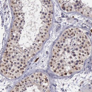 Anti-FGD1 antibody produced in rabbit 
