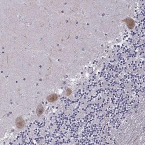 Anti-FGF3 antibody produced in rabbit 