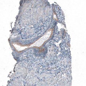 Anti-FGFR2 antibody produced in rabbit 