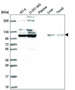Anti-FGFR2 antibody produced in rabbit HPA056562-100UL