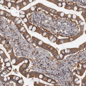 Anti-FGFR4 antibody produced in rabbit 