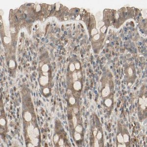 Anti-FHDC1 antibody produced in rabbit 