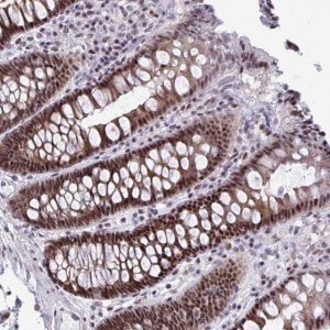 Anti-FIBCD1 antibody produced in rabbit 