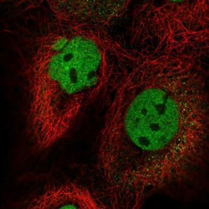 Anti-FIP1L1 antibody produced in rabbit 