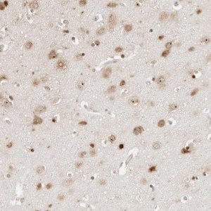 Anti-FKBP14 antibody produced in rabbit 
