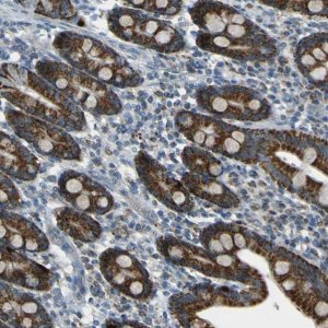 Anti-FKTN antibody produced in rabbit 