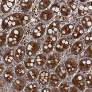 Anti-FLAD1 antibody produced in rabbit 