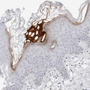 Anti-FLG2 antibody produced in rabbit 