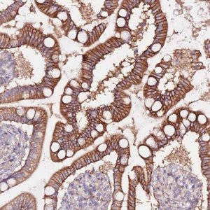 Anti-FLVCR1 antibody produced in rabbit 