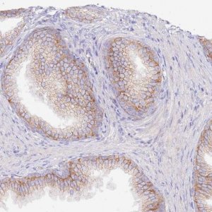 Anti-FLVCR1 antibody produced in rabbit 