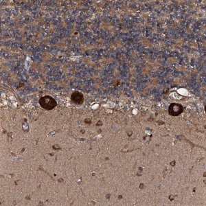 Anti-FLYWCH1 antibody produced in rabbit 